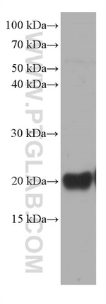 pan Ras Antibody in Western Blot (WB)