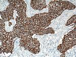 HER2/ErbB2 Antibody in Immunohistochemistry (Paraffin) (IHC (P))