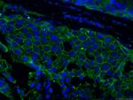 HER2/ErbB2 Antibody in Immunohistochemistry (PFA fixed) (IHC (PFA))