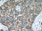 HER2/ErbB2 Antibody in Immunohistochemistry (Paraffin) (IHC (P))