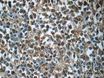 CDK2 Antibody in Immunohistochemistry (Paraffin) (IHC (P))