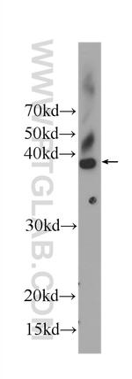 CDK2 Antibody in Western Blot (WB)