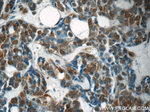 CDK2 Antibody in Immunohistochemistry (Paraffin) (IHC (P))