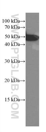 CREST Antibody in Western Blot (WB)