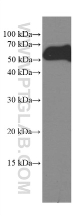 CREST Antibody in Western Blot (WB)