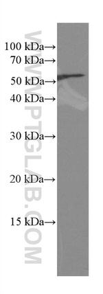 CREST Antibody in Western Blot (WB)