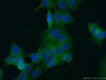 c-SRC Antibody in Immunocytochemistry (ICC/IF)