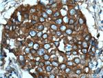 c-SRC Antibody in Immunohistochemistry (Paraffin) (IHC (P))