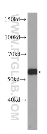 c-SRC Antibody in Western Blot (WB)