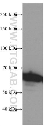 c-SRC Antibody in Western Blot (WB)