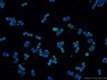 VCP Antibody in Immunocytochemistry (ICC/IF)