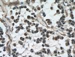 VCP Antibody in Immunohistochemistry (Paraffin) (IHC (P))