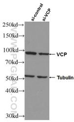 VCP Antibody in Western Blot (WB)