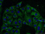 VCP Antibody in Immunocytochemistry (ICC/IF)