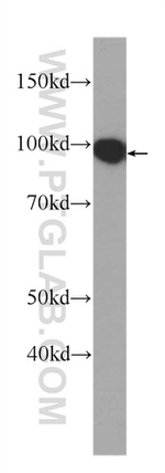 VCP Antibody in Western Blot (WB)