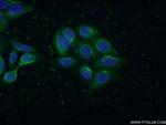 GOT1 Antibody in Immunocytochemistry (ICC/IF)