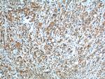 GOT1 Antibody in Immunohistochemistry (Paraffin) (IHC (P))