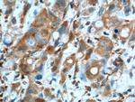 GOT1 Antibody in Immunohistochemistry (Paraffin) (IHC (P))