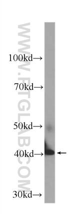 GOT1 Antibody in Western Blot (WB)