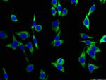HSP90 Antibody in Immunocytochemistry (ICC/IF)