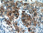 Cytokeratin 14 Antibody in Immunohistochemistry (Paraffin) (IHC (P))