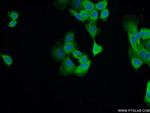 Cytokeratin 14 Antibody in Immunocytochemistry (ICC/IF)