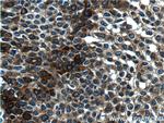 Cytokeratin 14 Antibody in Immunohistochemistry (Paraffin) (IHC (P))