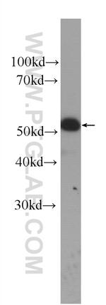 Cytokeratin 14 Antibody in Western Blot (WB)