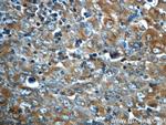 ALK/CD246 Antibody in Immunohistochemistry (Paraffin) (IHC (P))