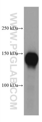 P-selectin Antibody in Western Blot (WB)