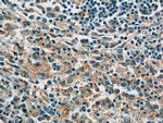 P-selectin Antibody in Immunohistochemistry (Paraffin) (IHC (P))