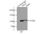 P-selectin Antibody in Immunoprecipitation (IP)