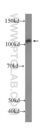 P-selectin Antibody in Western Blot (WB)