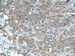 FGFR1 Antibody in Immunohistochemistry (Paraffin) (IHC (P))