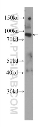 FGFR1 Antibody in Western Blot (WB)