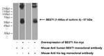 Bestrophin-1 Antibody in Western Blot (WB)