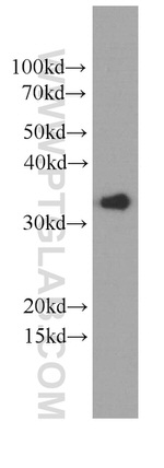 EEF1B2 Antibody in Western Blot (WB)