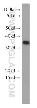 EEF1B2 Antibody in Western Blot (WB)