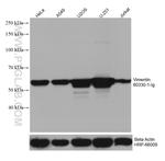 Vimentin Antibody in Western Blot (WB)