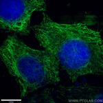 Vimentin Antibody in Immunocytochemistry (ICC/IF)