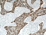 Vimentin Antibody in Immunohistochemistry (Paraffin) (IHC (P))