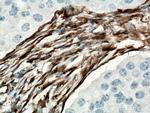 Vimentin Antibody in Immunohistochemistry (Paraffin) (IHC (P))