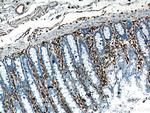 Vimentin Antibody in Immunohistochemistry (Paraffin) (IHC (P))