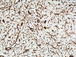 Vimentin Antibody in Immunohistochemistry (Paraffin) (IHC (P))