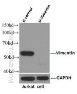 Vimentin Antibody in Western Blot (WB)