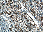 Vimentin Antibody in Immunohistochemistry (Paraffin) (IHC (P))