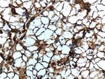 Vimentin Antibody in Immunohistochemistry (Paraffin) (IHC (P))