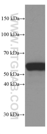 Vimentin Antibody in Western Blot (WB)