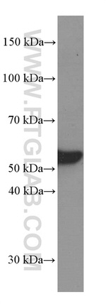 Vimentin Antibody in Western Blot (WB)