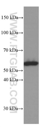 Vimentin Antibody in Western Blot (WB)